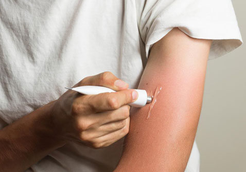 丘疹性荨麻疹根治方法怎么治疗最快止痒消退