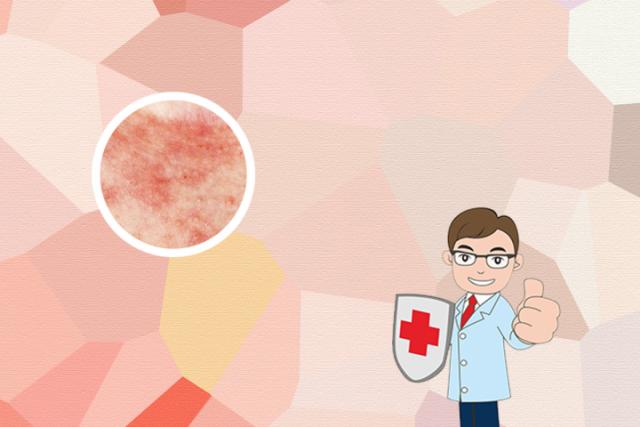 湿疹是怎么得的传染吗