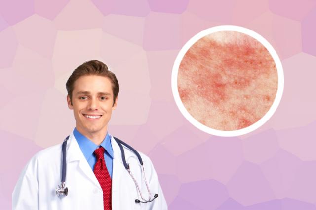 皮肤癣和湿疹的区别图片
