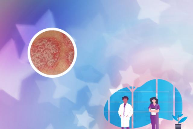 角化性湿疹是什么