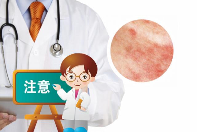 湿疹都有哪些症状会传染吗