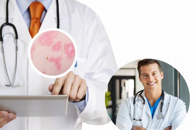 癣菌疹是什么