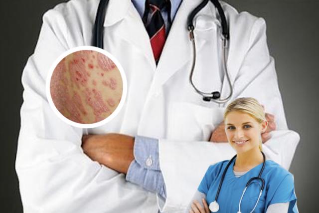 湿疹是怎么导致的 马拉色菌