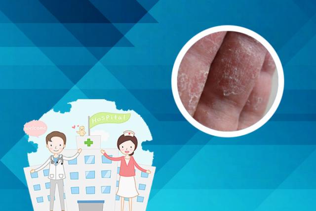 慢性湿疹有什么症状表现