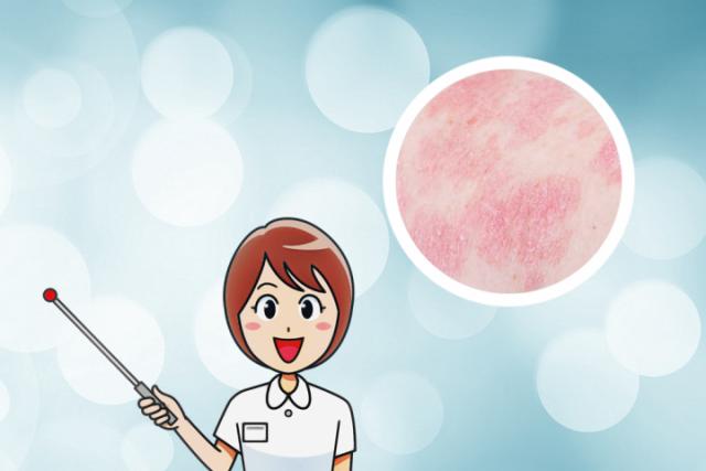 儿童湿疹和热疹的区别图片