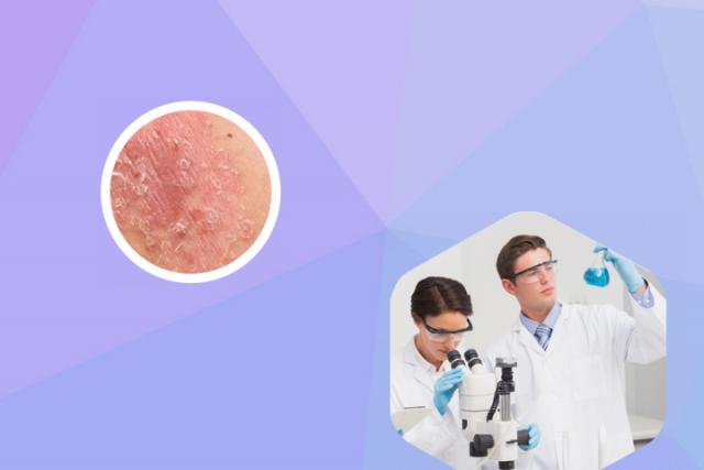 湿疹引起的皮肤感染是什么症状