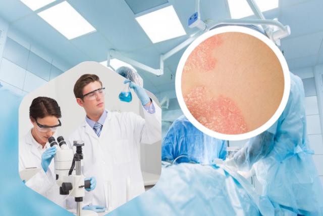 湿疹 荨麻疹图片初期症状图片