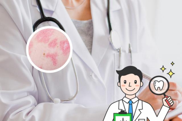 免疫力低下的皮肤病怎么治