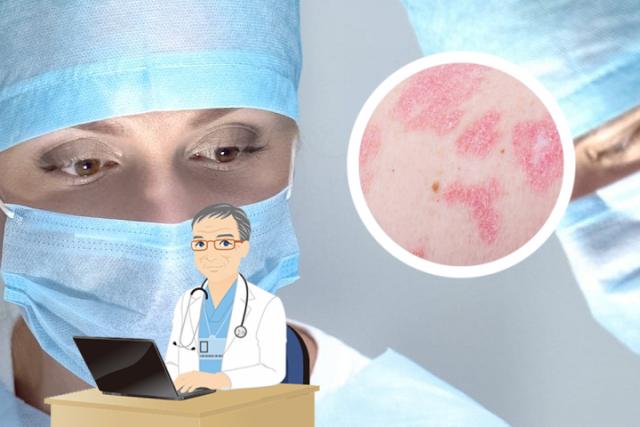 湿疹皮炎图片和症状