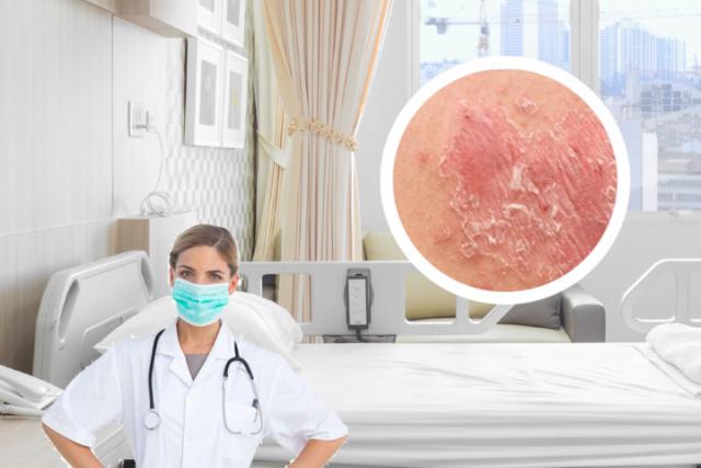 湿疹和热疹的区别是什么